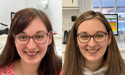 invisalign and teeth whitening Y bont